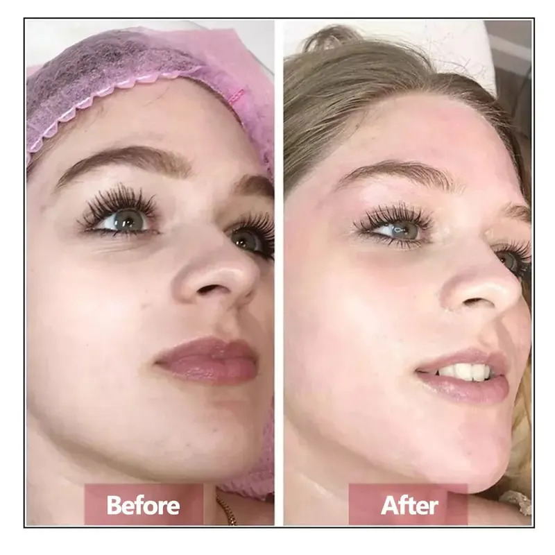 ヒアルロン酸フェイスセラムエッセンス肌の修復若返り引き締め保 - Hyaluronic Acid Facial Serum のレビューと価格