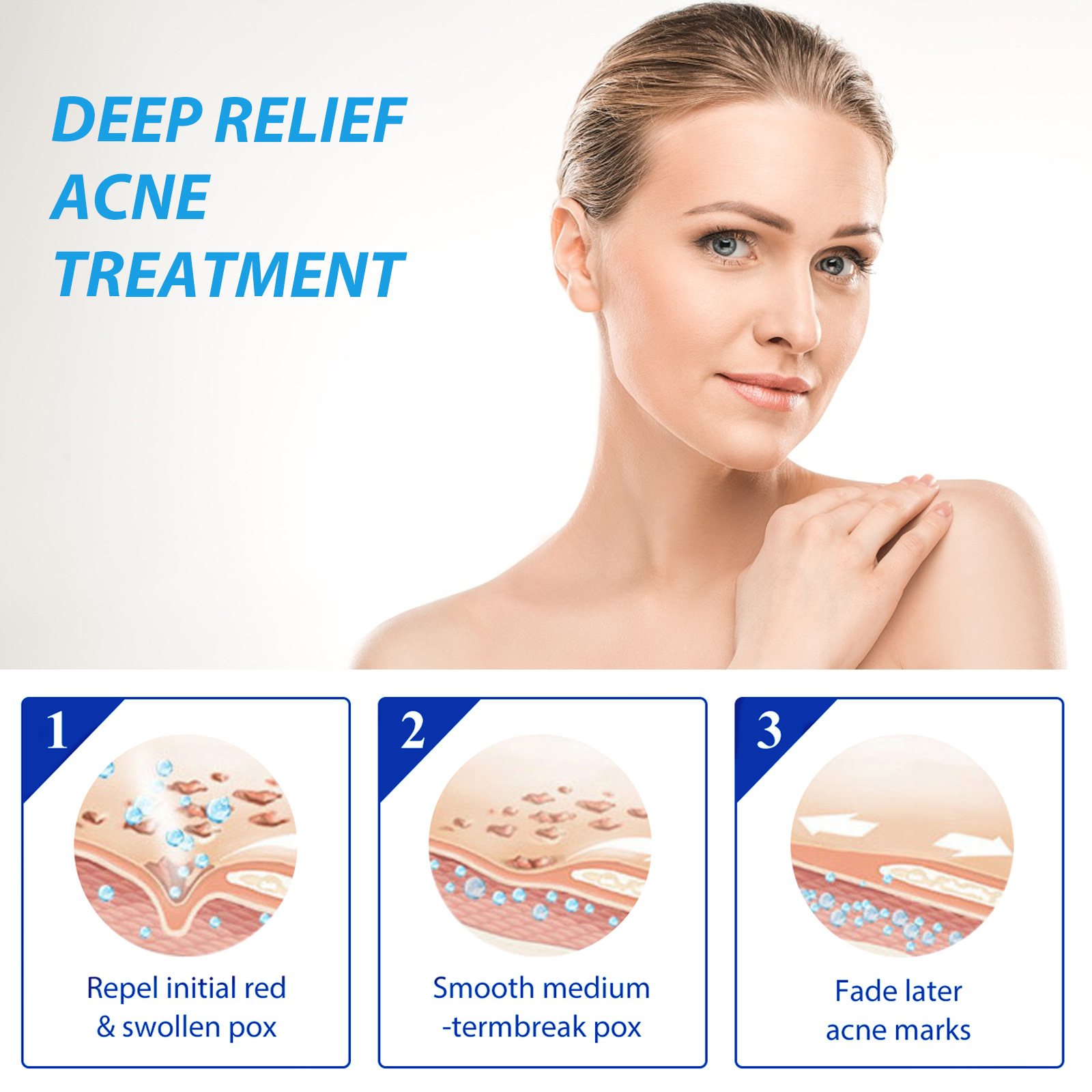 EELHINO-にきび治療用サンダルローション,液体,毛穴の - Salicylic Acid Blackhead Remover のレビューと価格